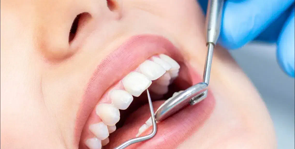 عصب کشی دندان قدامی و ۴و۵ پایین با کمترین هزینه|خدمات آرایشگری و زیبایی|شیراز, تحویلی|دیوار