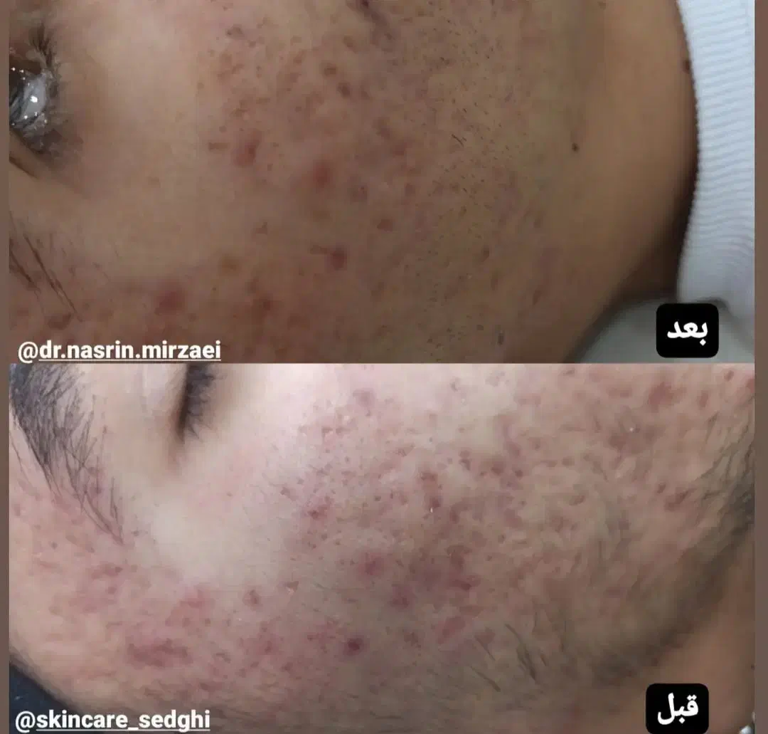 نیازمند همکاری با سالنهای ارایشی|خدمات آرایشگری و زیبایی|سهند, |دیوار