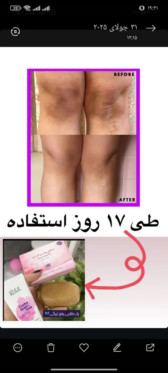 پک روشنایی ورفع تیرگی صورت وبدن|حراج|زرند, |دیوار