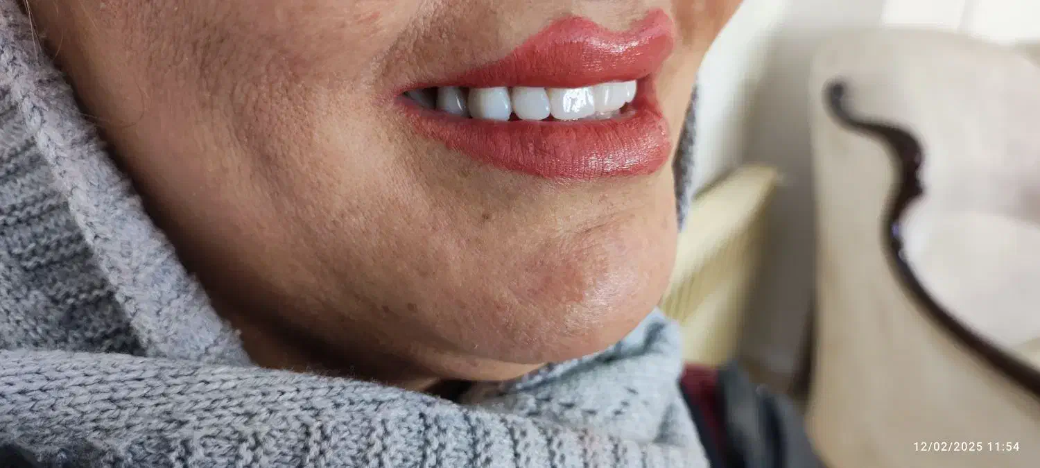 دندانسازی (فقط با ۱۵ میلیون )|خدمات آرایشگری و زیبایی|پرند, فاز ۲|دیوار