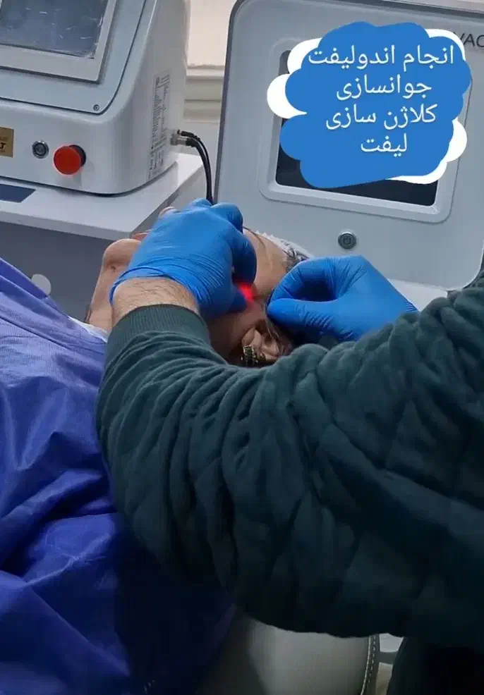 جشنواره بلفاروپلاستی ،اندولیف ،ساکشن غبغب|خدمات آرایشگری و زیبایی|تهران, بلوار کشاورز|دیوار