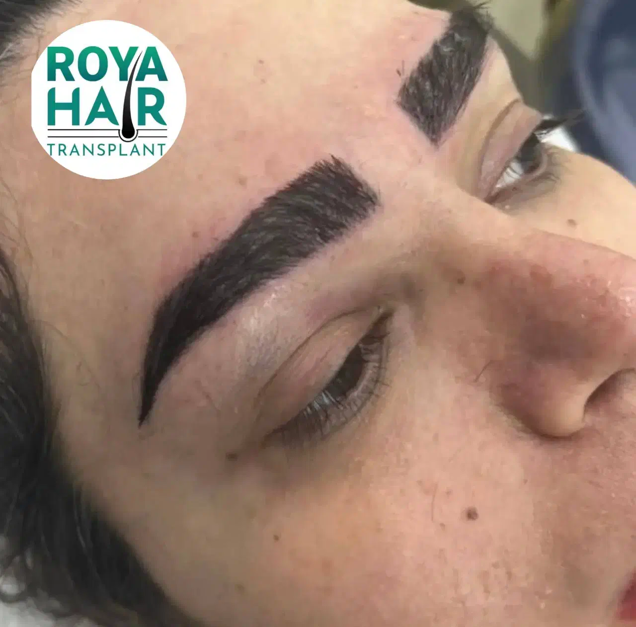 کاشت ابرو تضمینی توسط تکنولوژیست جراحی|خدمات آرایشگری و زیبایی|شیراز, چوگیاه‎|دیوار