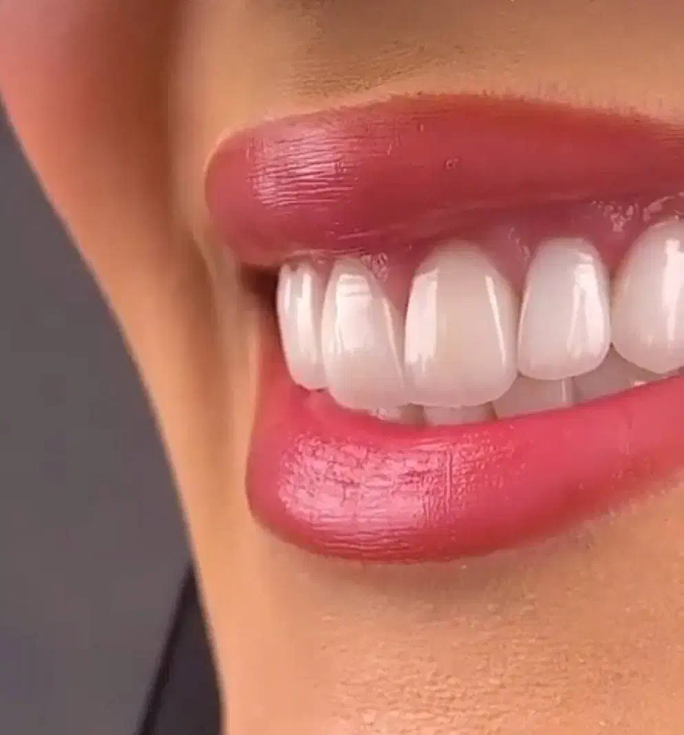 دندانپزشکی و ایمپلنت و کامپوزیت و ارتودنسی|خدمات آرایشگری و زیبایی|سرپل ذهاب, |دیوار