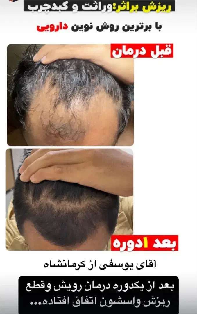 تونیک هیر فرند|آرایشی، بهداشتی، درمانی|شیراز, کوشک میدان|دیوار