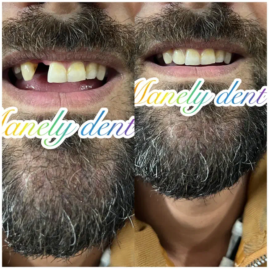 دندان مصنوعی ۲۰٪تخفیف|آرایشی، بهداشتی، درمانی|آمل, |دیوار