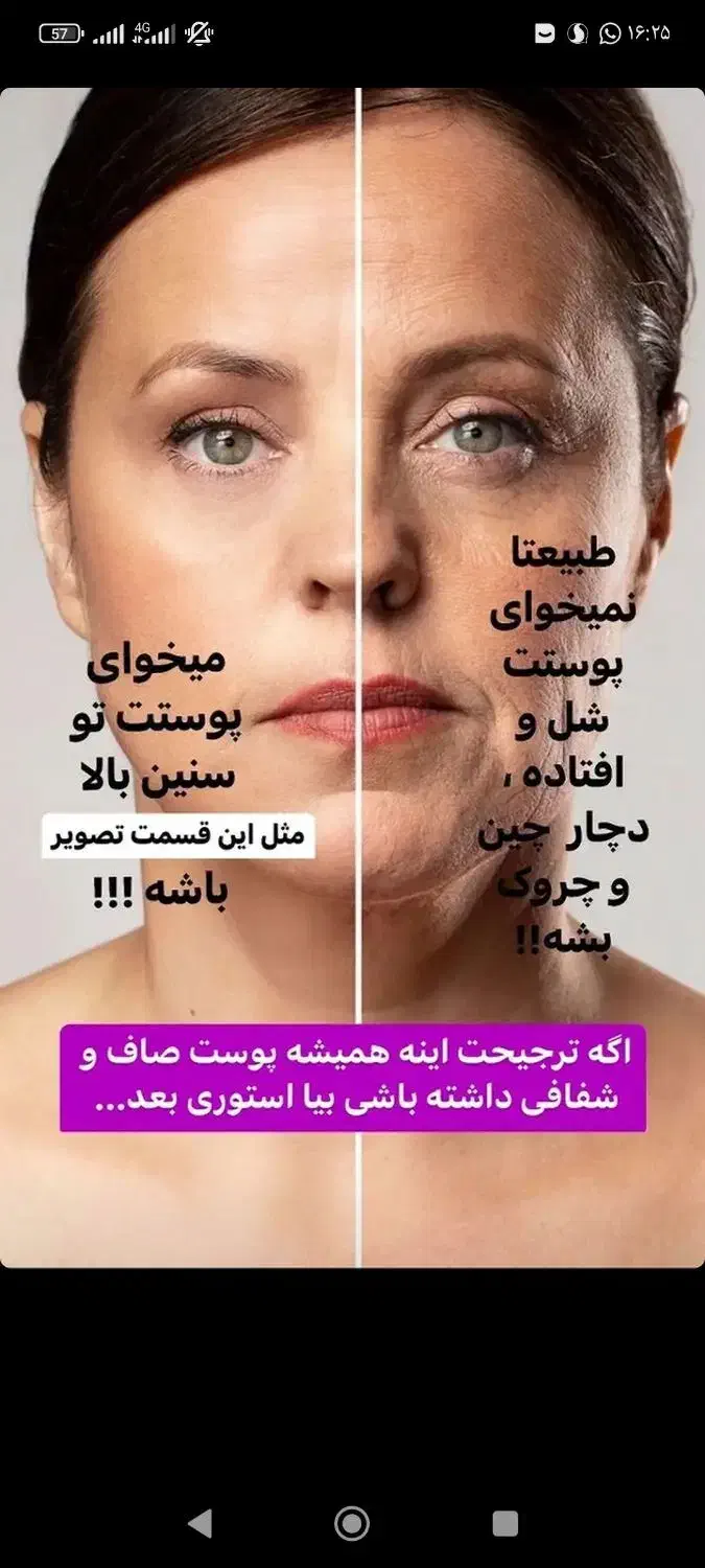 چین و چروک گاتیو|آرایشی، بهداشتی، درمانی|قم, آذر (نکویی)|دیوار