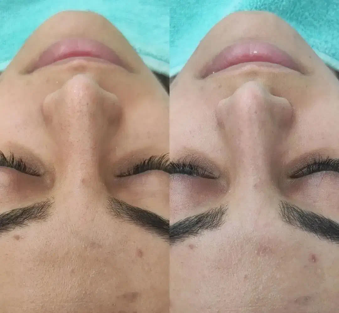 تخفیف ویژه پاکساژی و ماساژ صورت|خدمات آرایشگری و زیبایی|سقز, |دیوار