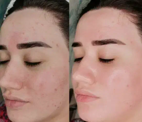 کرم پودر دائم|خدمات آرایشگری و زیبایی|زاهدان, |دیوار