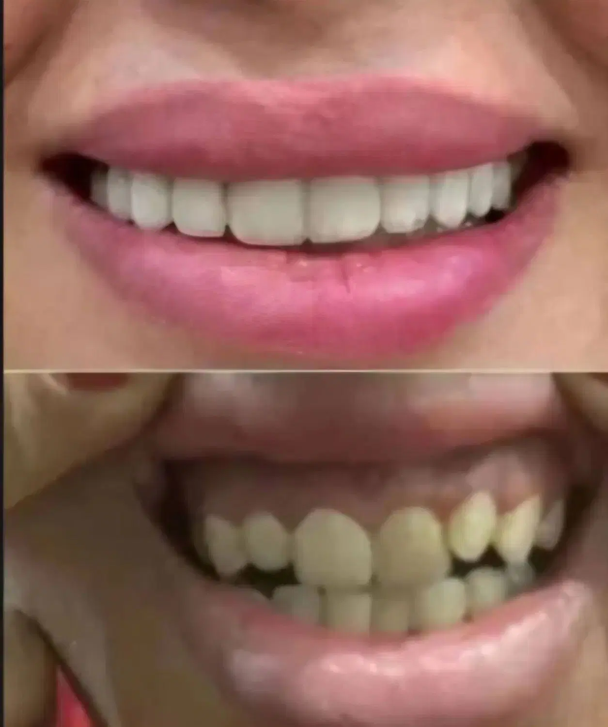 اقساط ویژه ایمپلنت دیجیتال،اوردنچر،دندان مصنوعی..|خدمات زیبایی و سلامت|تهران, مجیدیه|دیوار