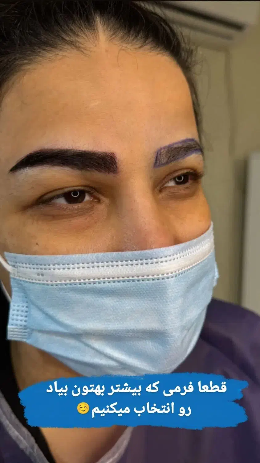 جشنواره پاییزی کاشت مو وابرو|خدمات آرایشگری و زیبایی|رباط‌کریم, رباط‌کریم|دیوار