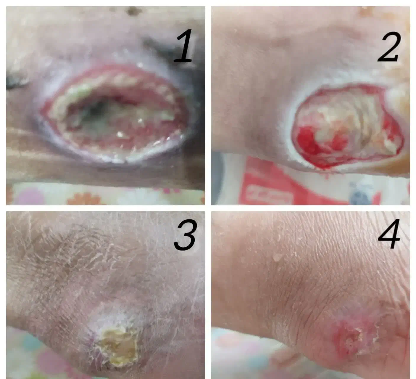 کارشناس درمانگر تخصصی زخم ،مراقب و پرستار در منزل|خدمات آرایشگری و زیبایی|مشهد, وکیلآباد|دیوار