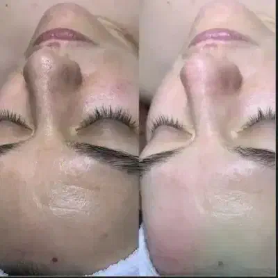 پاکسازی پوست|خدمات آرایشگری و زیبایی|اسلامآباد غرب, |دیوار