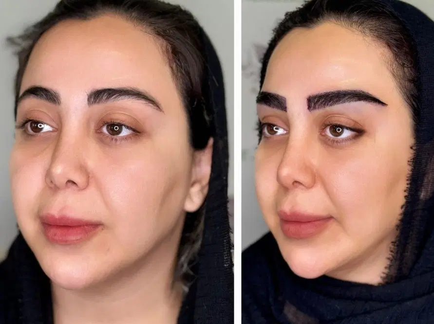 میکروکاشت ابرو و مو فقط 16.800 ظرفیت محدود|خدمات زیبایی و سلامت|قم, زنبیل آباد|دیوار