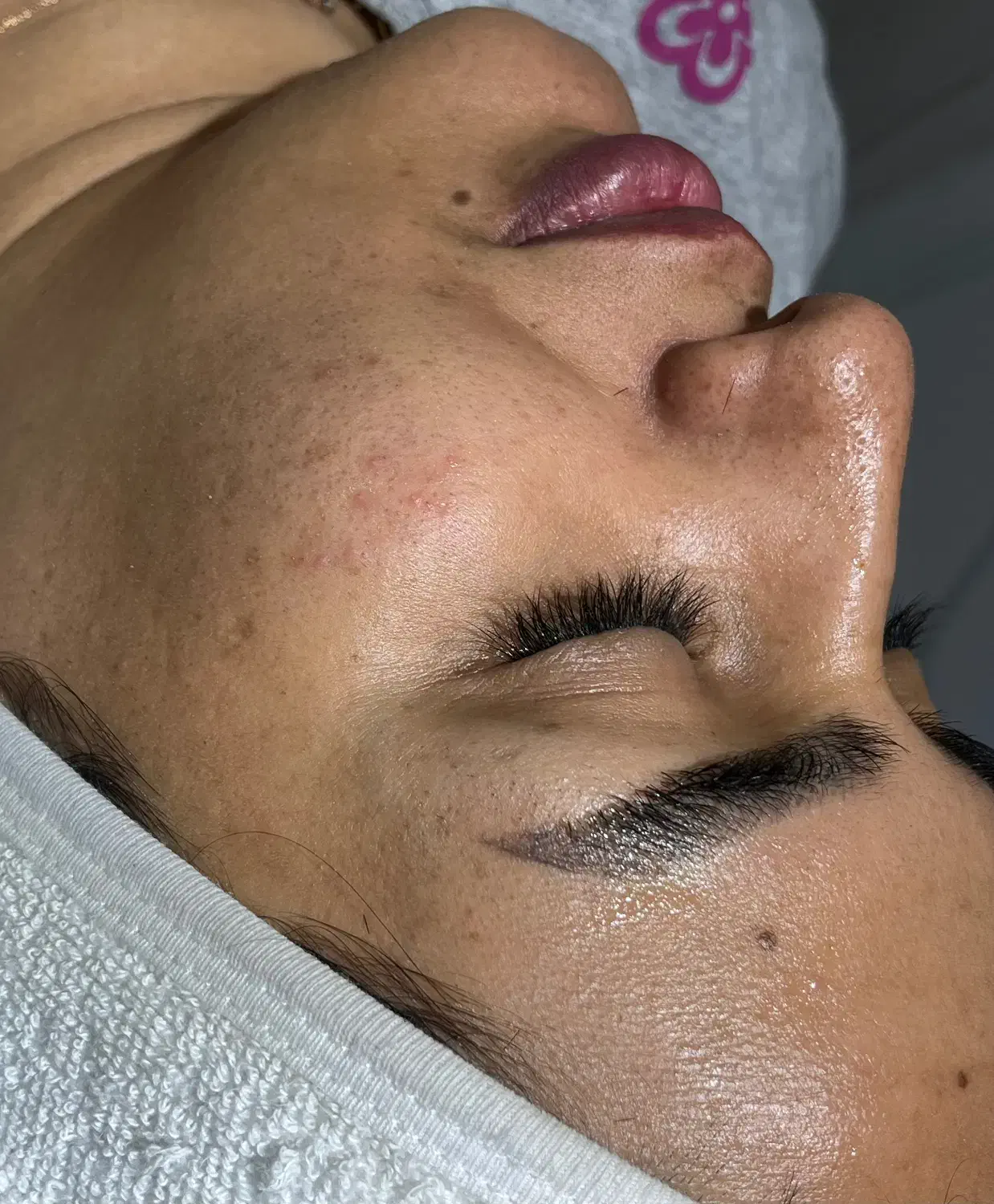 فیشال و پاکسازی صورت|خدمات آرایشگری و زیبایی|شیراز, شهرک فرزانگان|دیوار