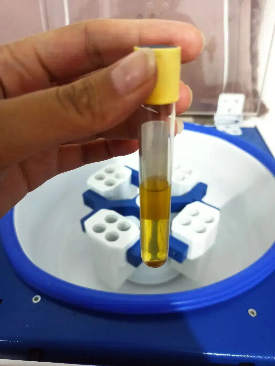 پی ارپی صورت ومو ومزوتراپی صورت ومو تخفیف ویژه|خدمات آرایشگری و زیبایی|کازرون, |دیوار