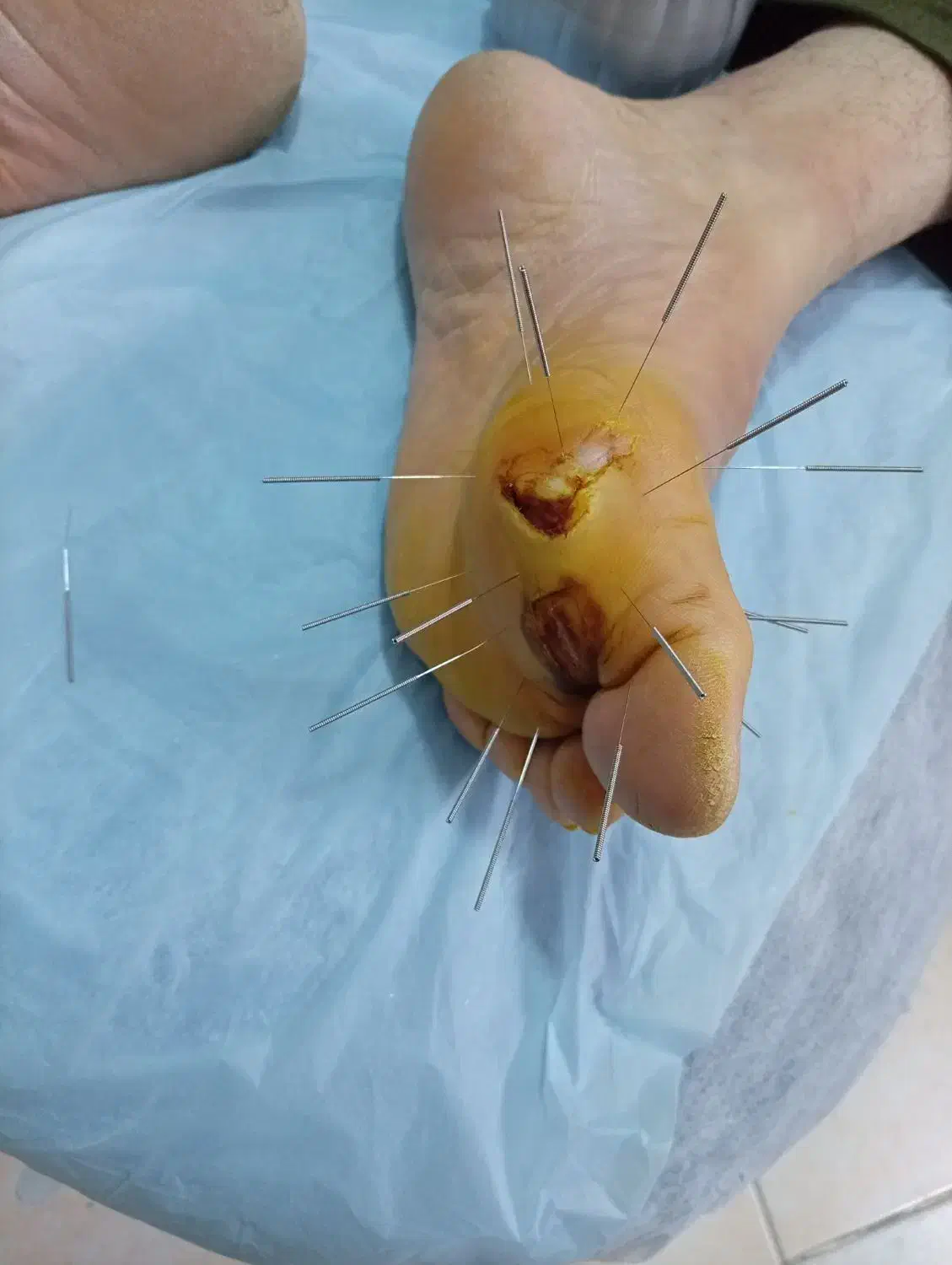 درمان تضمینی بیماری های لاعلاج و صعب العلاج|خدمات آرایشگری و زیبایی|فردیس, فردیس|دیوار