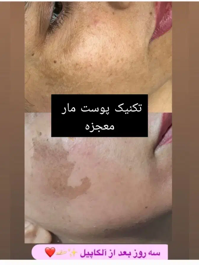 فیشیال صورت آقایان و خانم ها مطب دکترپروین گودرزی|خدمات آرایشگری و زیبایی|یاسوج, |دیوار