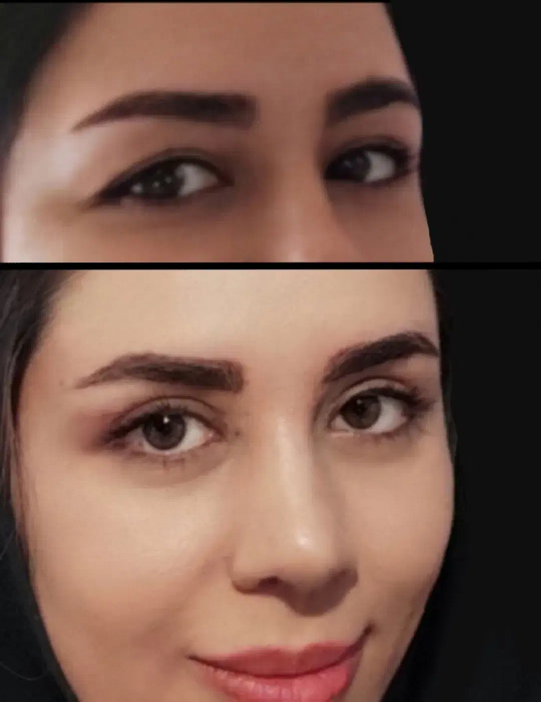 بلفاروپلاستی رفع پلک مدل بخیه لیزری/سانترال/بوکال|خدمات آرایشگری و زیبایی|تهران, هفت حوض|دیوار