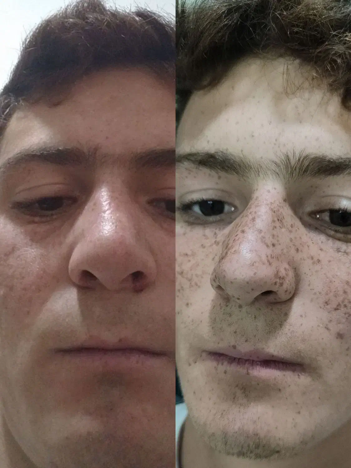 حذف دائمی کک و مک|خدمات آرایشگری و زیبایی|تربت جام, المهدی|دیوار