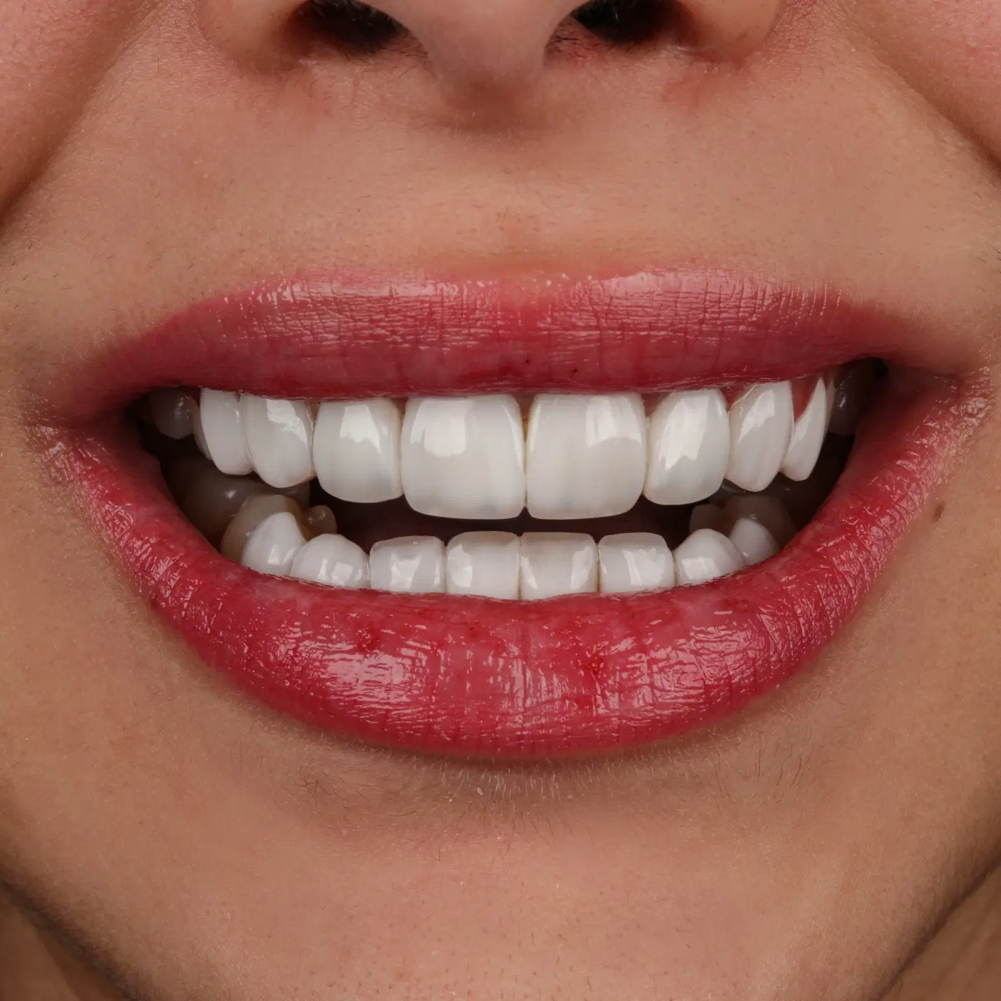 تمامی خدمات دندانپزشکی با تعرفه دولتی|خدمات زیبایی و سلامت|شیراز, خلیلی|دیوار