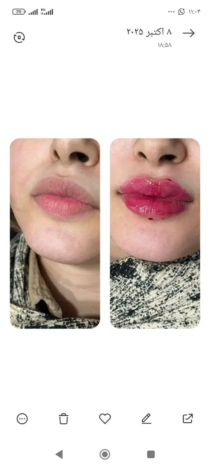خدمات ژل و بوتاکس ولیزر و فیشیال و...|خدمات آرایشگری و زیبایی|اهواز, پادادشهر|دیوار