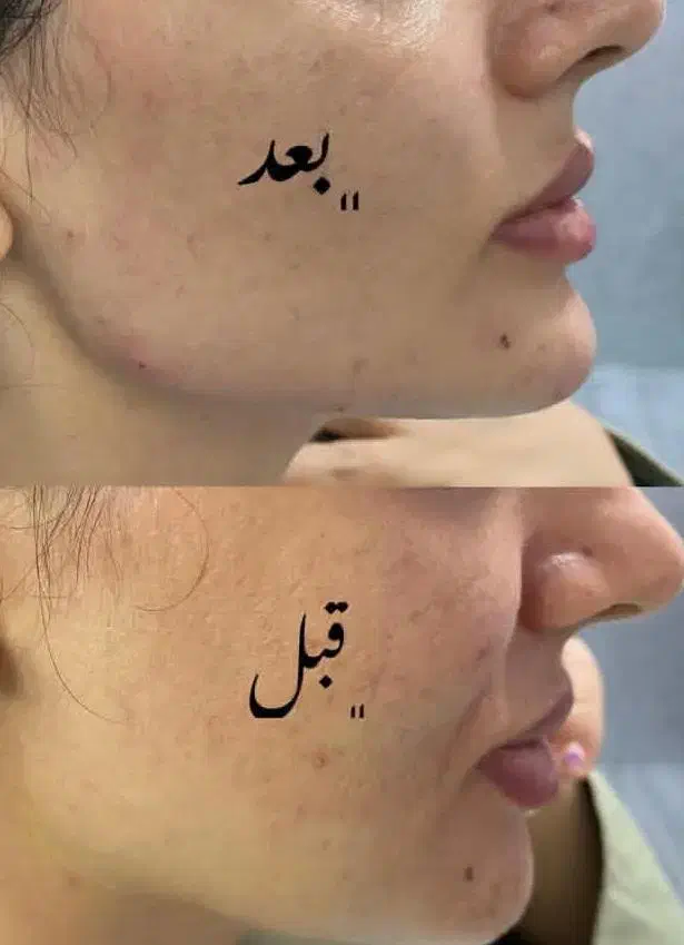 کلینیک زیبایی آذربایجان|خدمات آرایشگری و زیبایی|گرمی, |دیوار