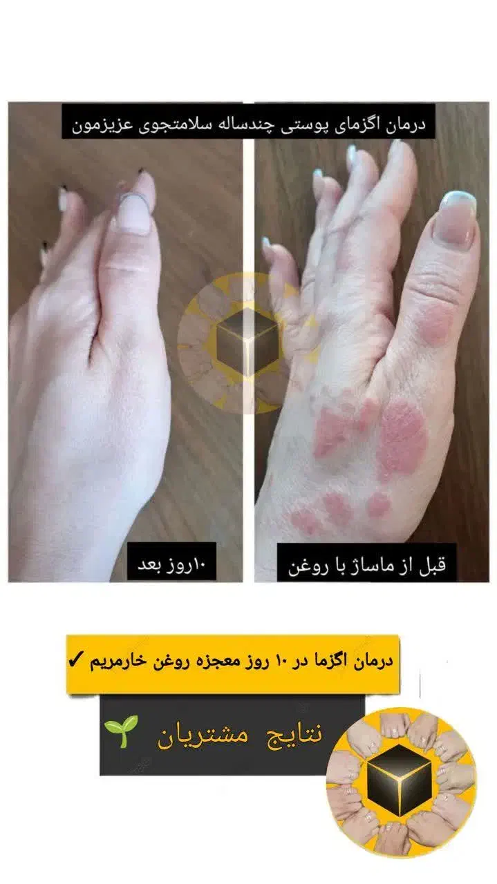 تشخیص بیماریها از روی زبان و درمان|خدمات آرایشگری و زیبایی|جیرفت, |دیوار