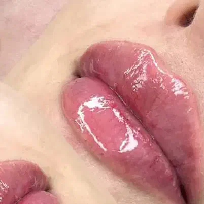 آموزش ژل و بوتاکس فقط ۵۸۰۰|خدمات آموزشی|فولادشهر, C3|دیوار