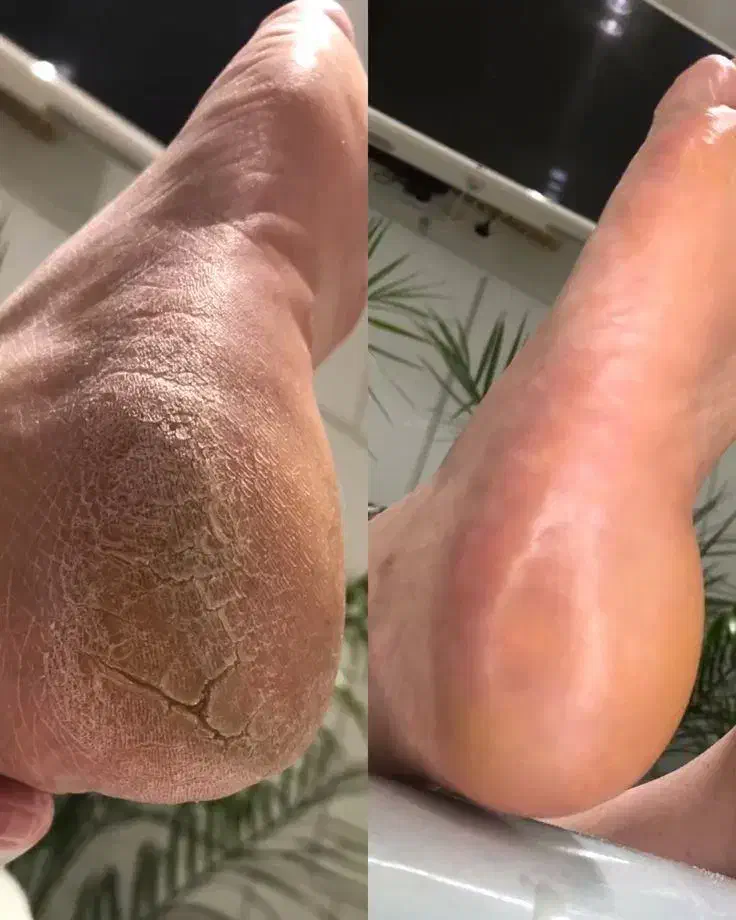 خدمات ناخن پدیکور و کفسابی پا|خدمات آرایشگری و زیبایی|شاهین‌شهر, عطار|دیوار