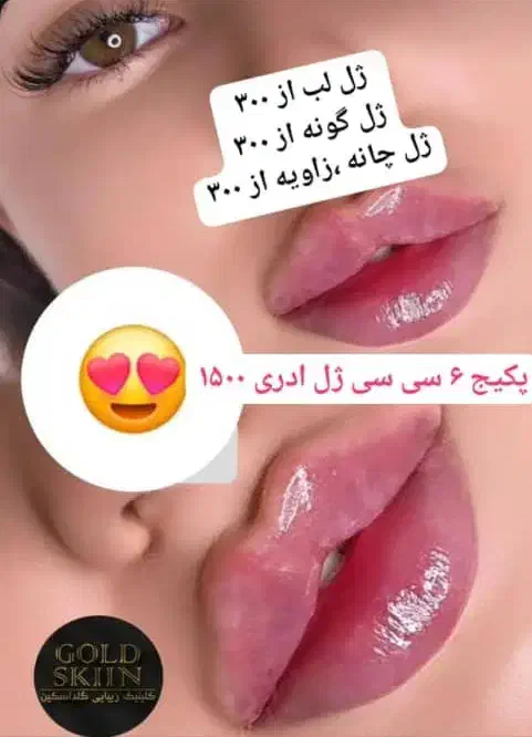 ژل لب عروسکی بوتاکس مزو سرصورت جالپرو سوپرهیدرو|خدمات آرایشگری و زیبایی|تهران, صادقیه|دیوار