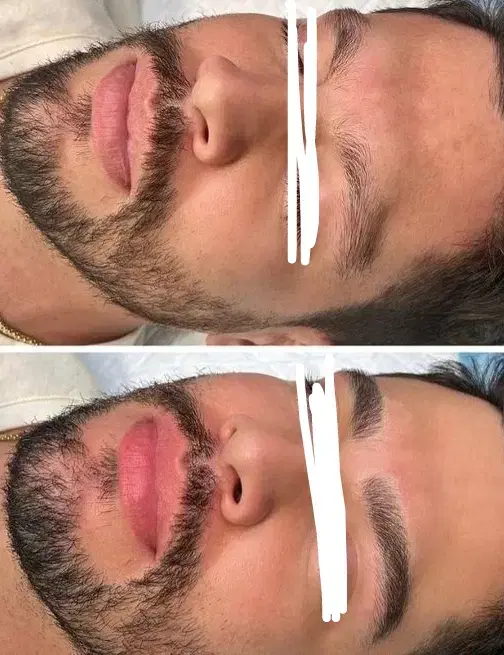 رفع نواقص ابرو در اقایان/میکرو /لیفت ابرو|خدمات زیبایی و سلامت|تبریز, |دیوار