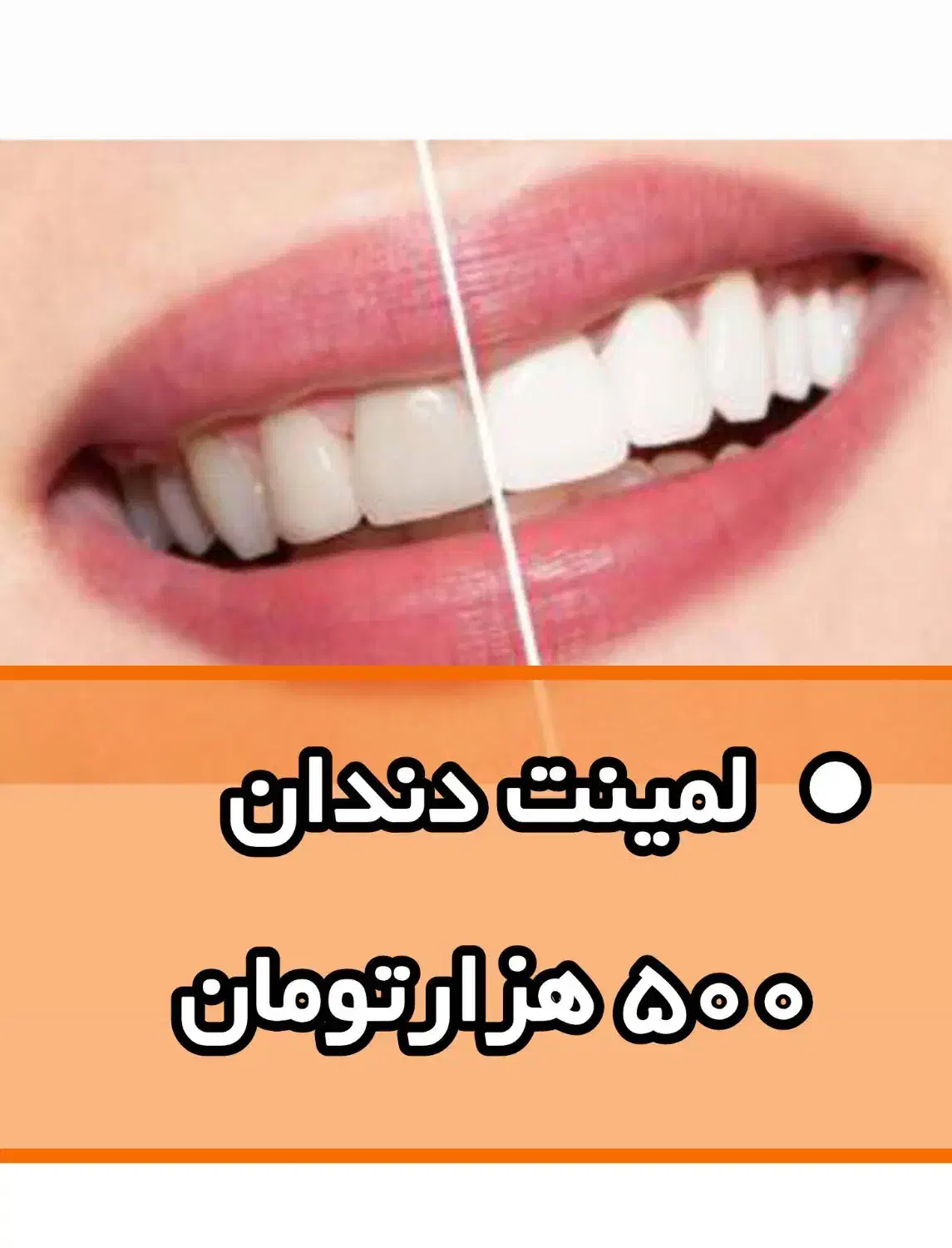 رایموندLM|تخت و صندلی بچه|اهواز, مهرشهر|دیوار