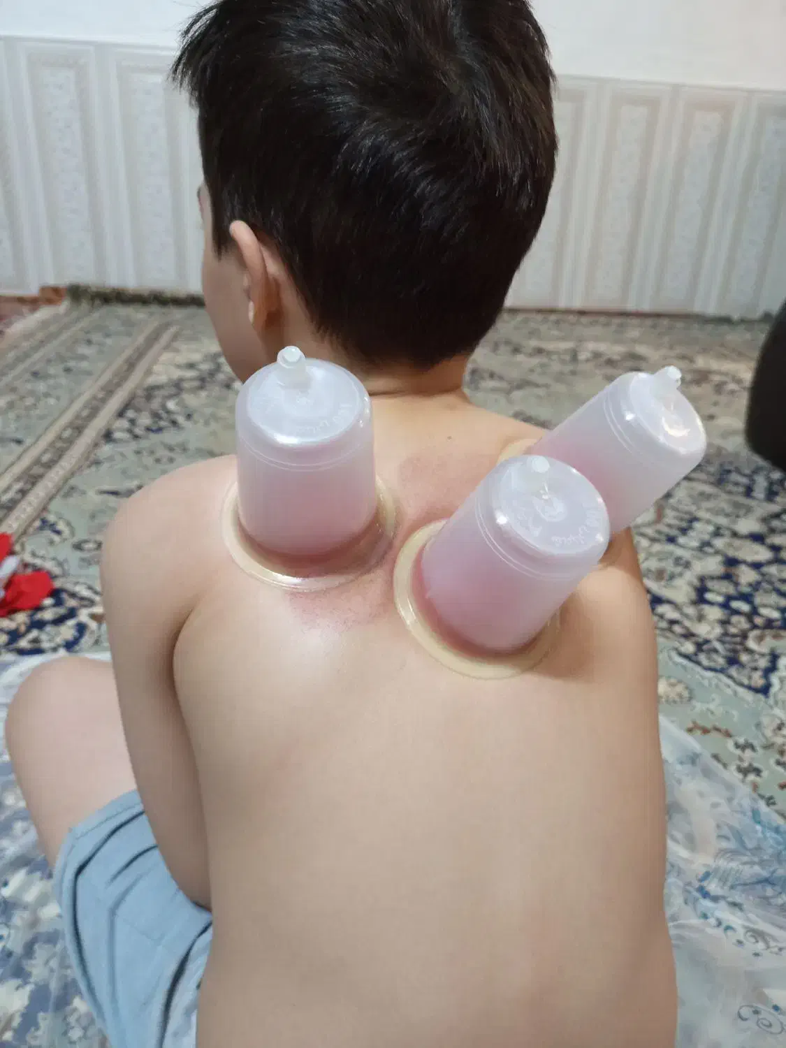 زالو|خزنده|زنجان, |دیوار