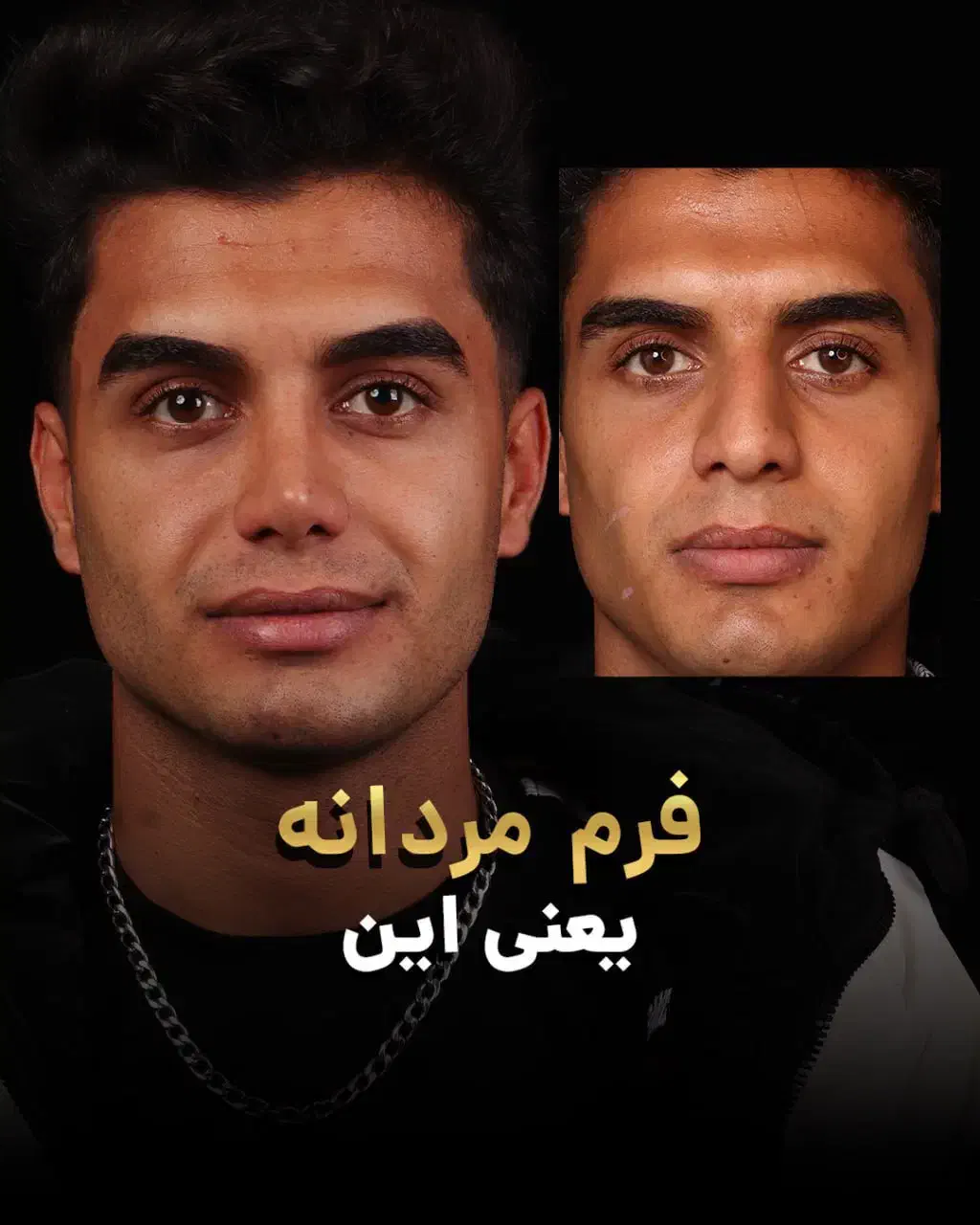 عمل بینی بدون بازگشت|خدمات آرایشگری و زیبایی|تهران, قبا|دیوار