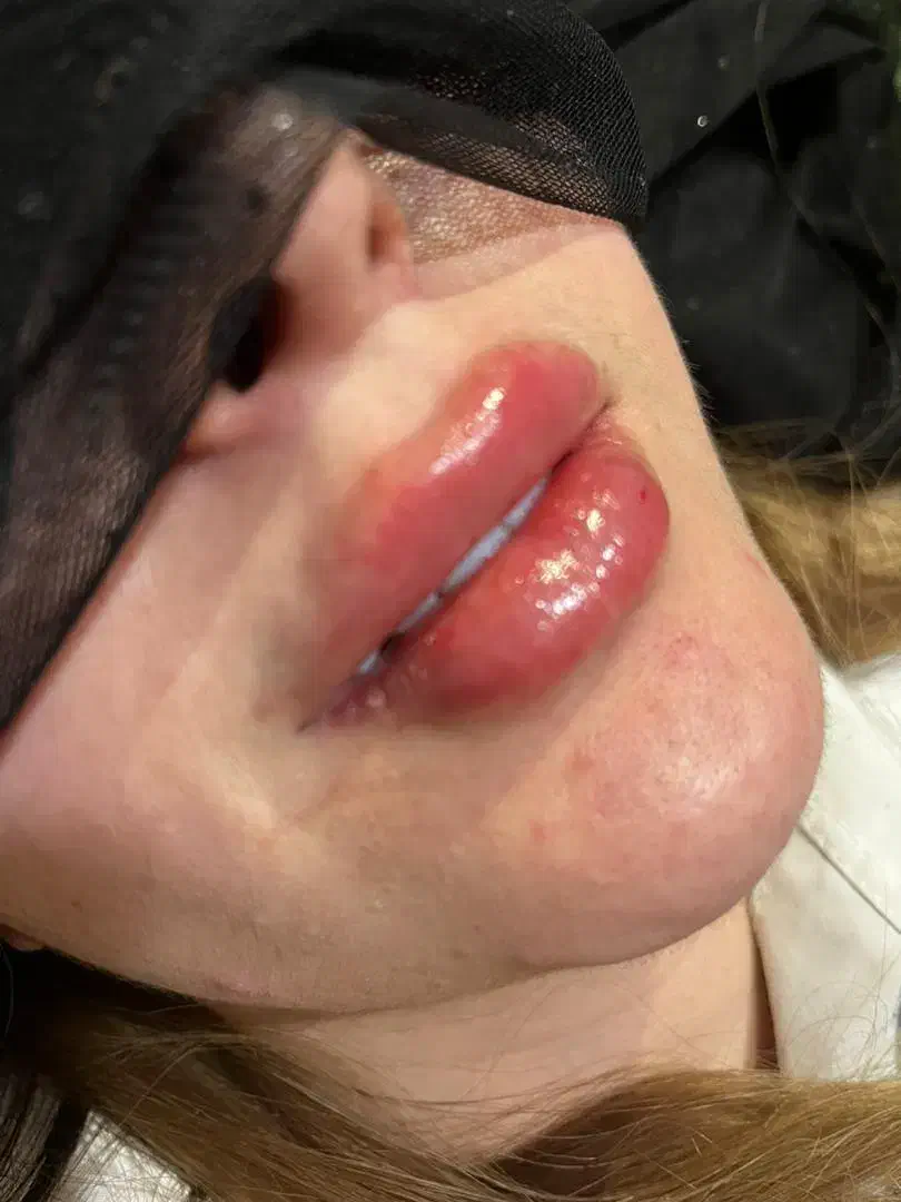 فیلر هر برندی مشتری بخواد|خدمات آرایشگری و زیبایی|یاسوج, |دیوار