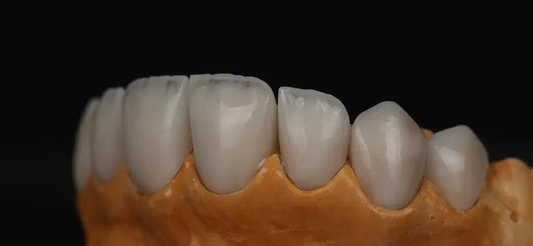 دستیار ومنشی دندانپزشکی|استخدام درمانی، زیبایی، بهداشتی|تهران, نیاوران|دیوار