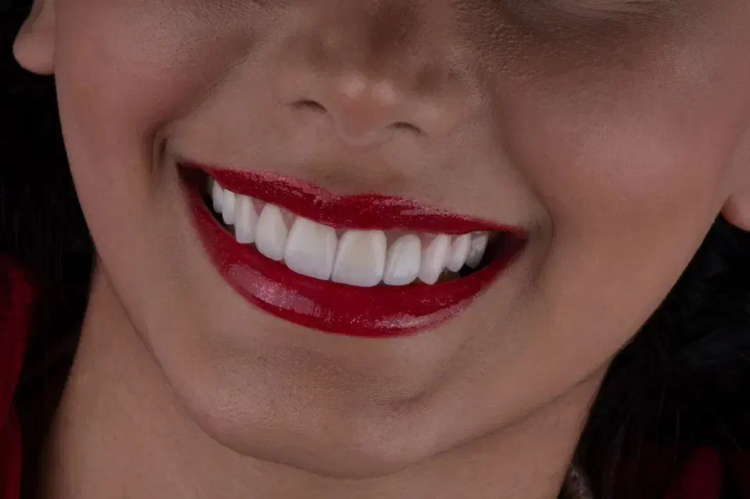 مرکز تخصصی ایمپلنت دیجیتال..|خدمات آرایشگری و زیبایی|تهران, زعفرانیه|دیوار