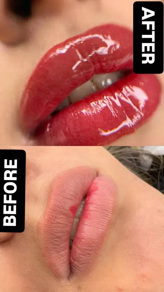 پزشک زیبایی دارای پروانه مطب|خدمات آرایشگری و زیبایی|مشهد, کوثر|دیوار