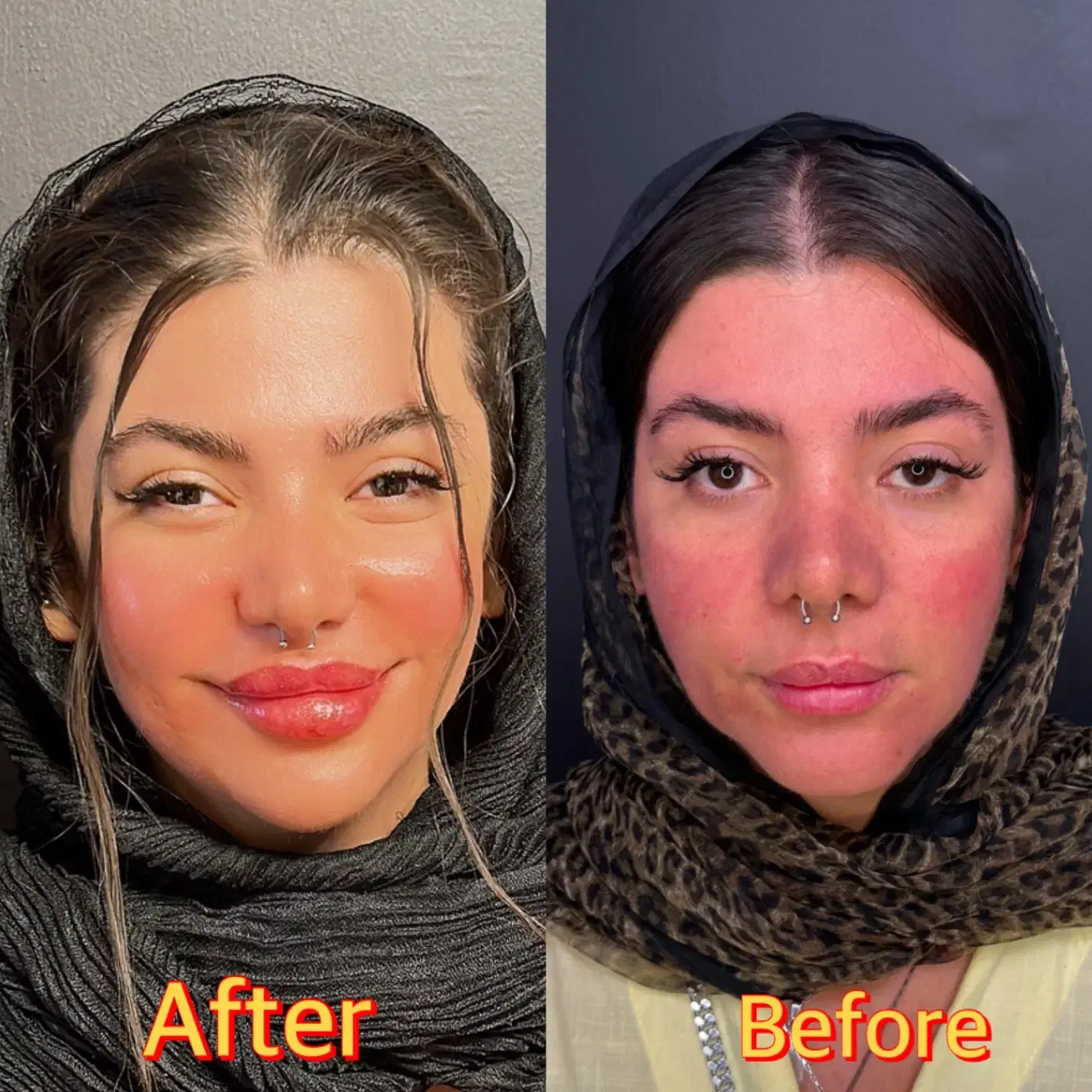 خدمات پوست، مو ، زیبایی|خدمات آرایشگری و زیبایی|تهران, امانیه|دیوار