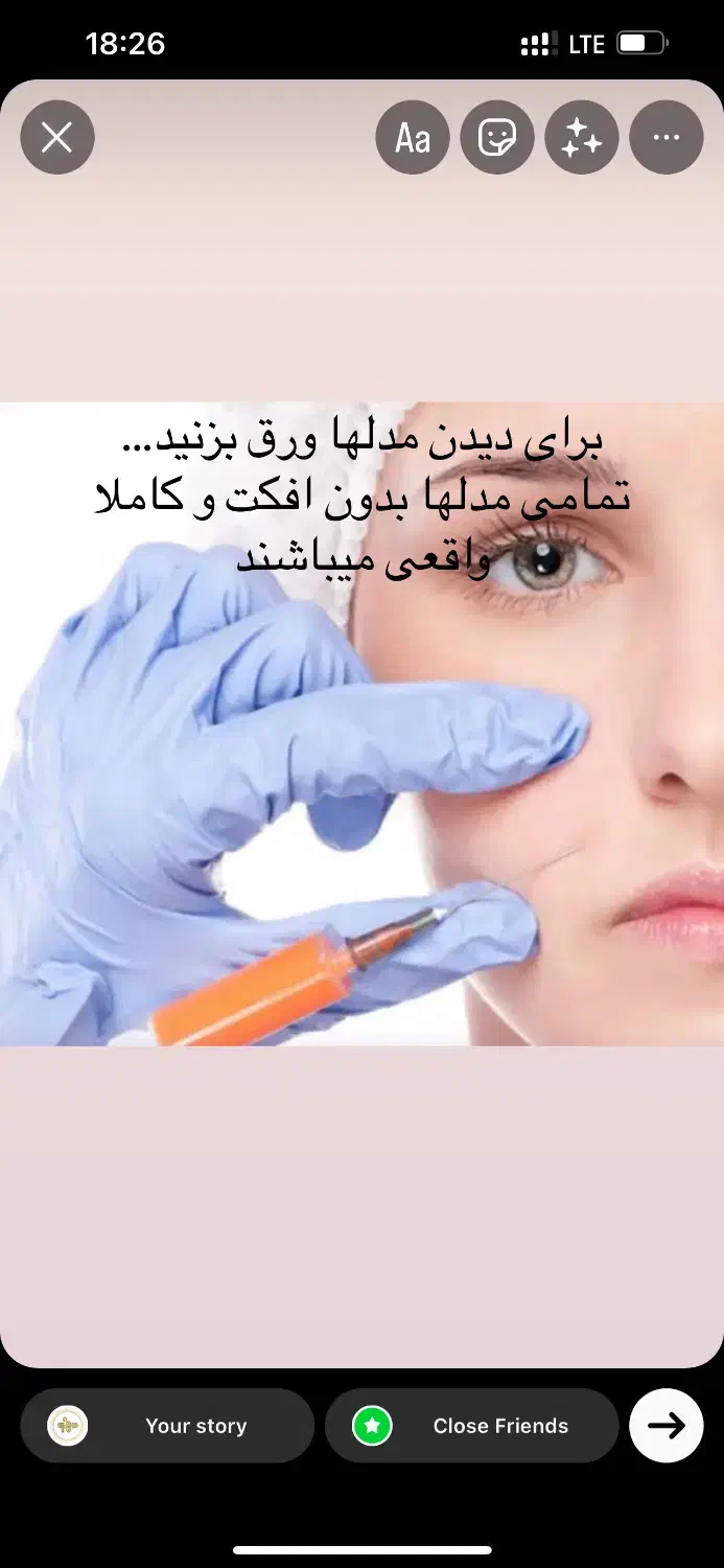 تزریق چربی به تمام نواحی|خدمات آرایشگری و زیبایی|قزوین, |دیوار