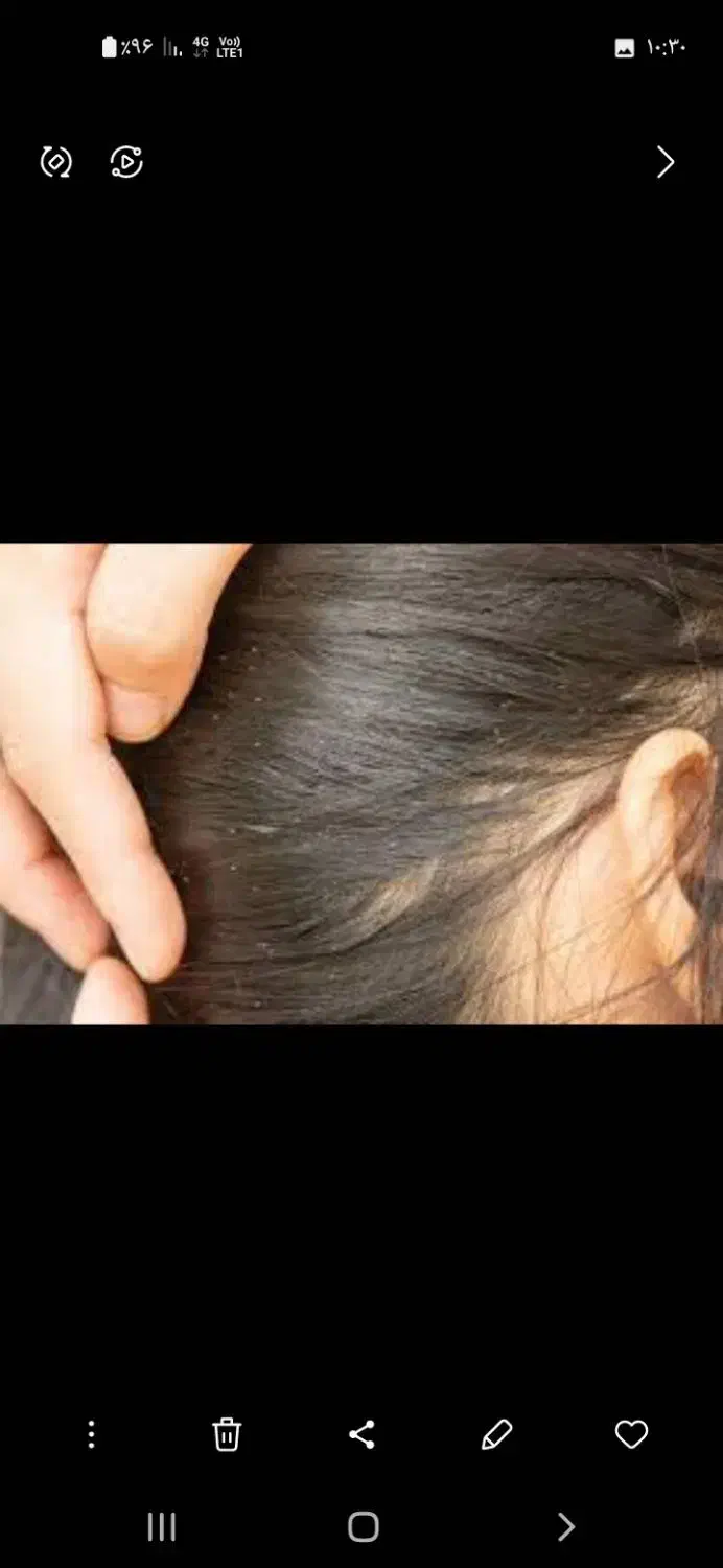 پاکسازی رشک و شپش|آرایشی، بهداشتی، درمانی|مشهد, مصلی (کارمندان اول)|دیوار