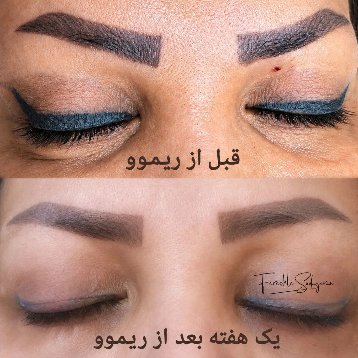 مرکز تخصصی ریموو وآرایش دائم فرشته سوداگران|خدمات زیبایی و سلامت|تهران, فدک|دیوار