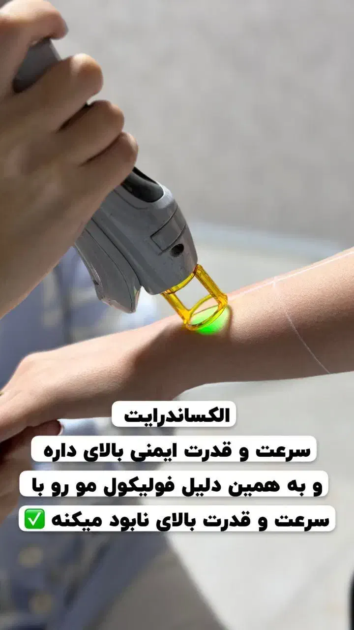 لیزر مو زائد با الکساندرایت شاتی کندلا اصل|خدمات آرایشگری و زیبایی|آمل, |دیوار