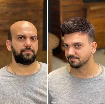 خدا حافظی با بی مویی|خدمات آرایشگری و زیبایی|فردیس, فردیس|دیوار