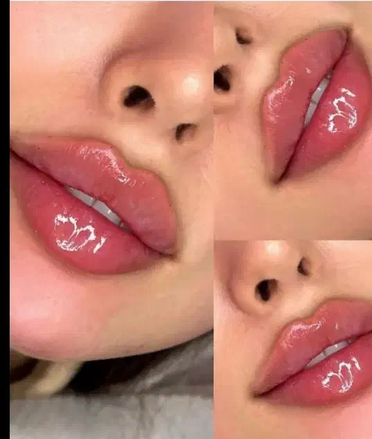 جشنواره تخفیفات ژل بوتاکس دکترکاظمی|خدمات آرایشگری و زیبایی|مشهد, کوثر|دیوار