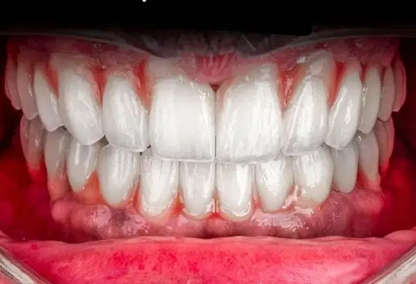 مرکز تخصصی دندان پزشکی و ایمپلنت مختص افراد حساس|خدمات زیبایی و سلامت|تبریز, |دیوار