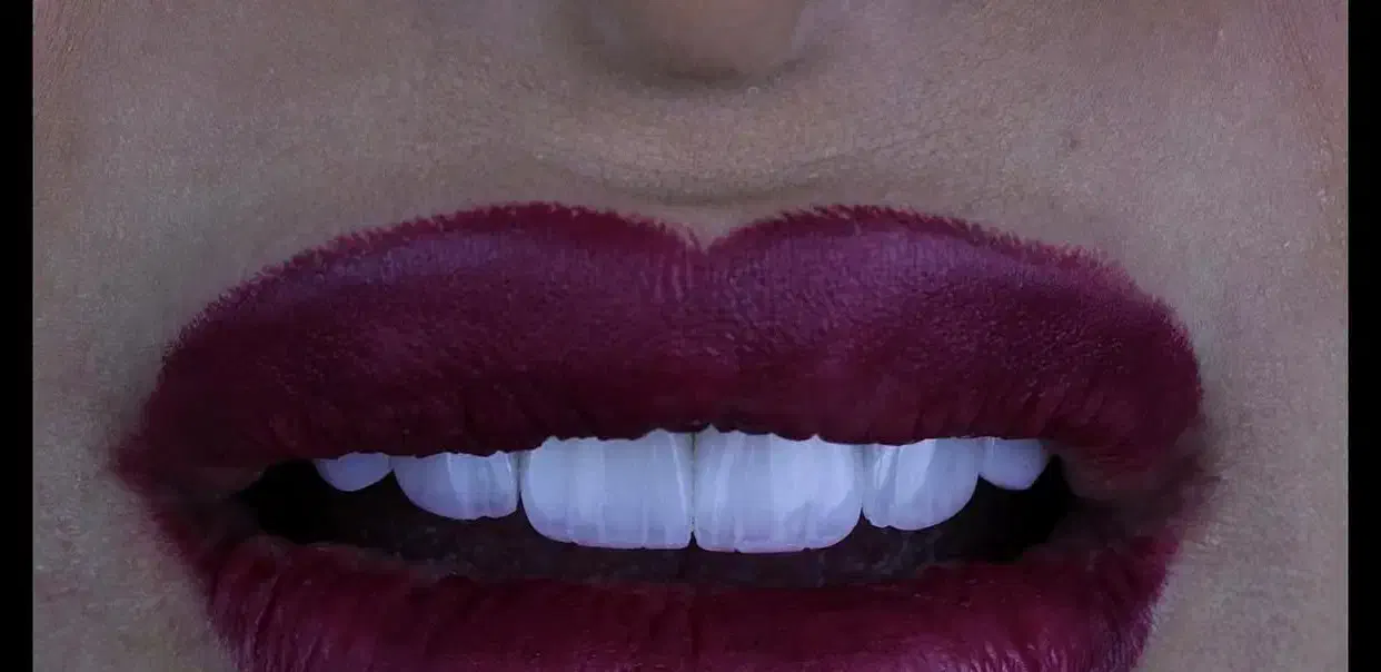 کامپوزیت دندان فکی ۸میلیون|خدمات آرایشگری و زیبایی|پرند, فاز ۰|دیوار