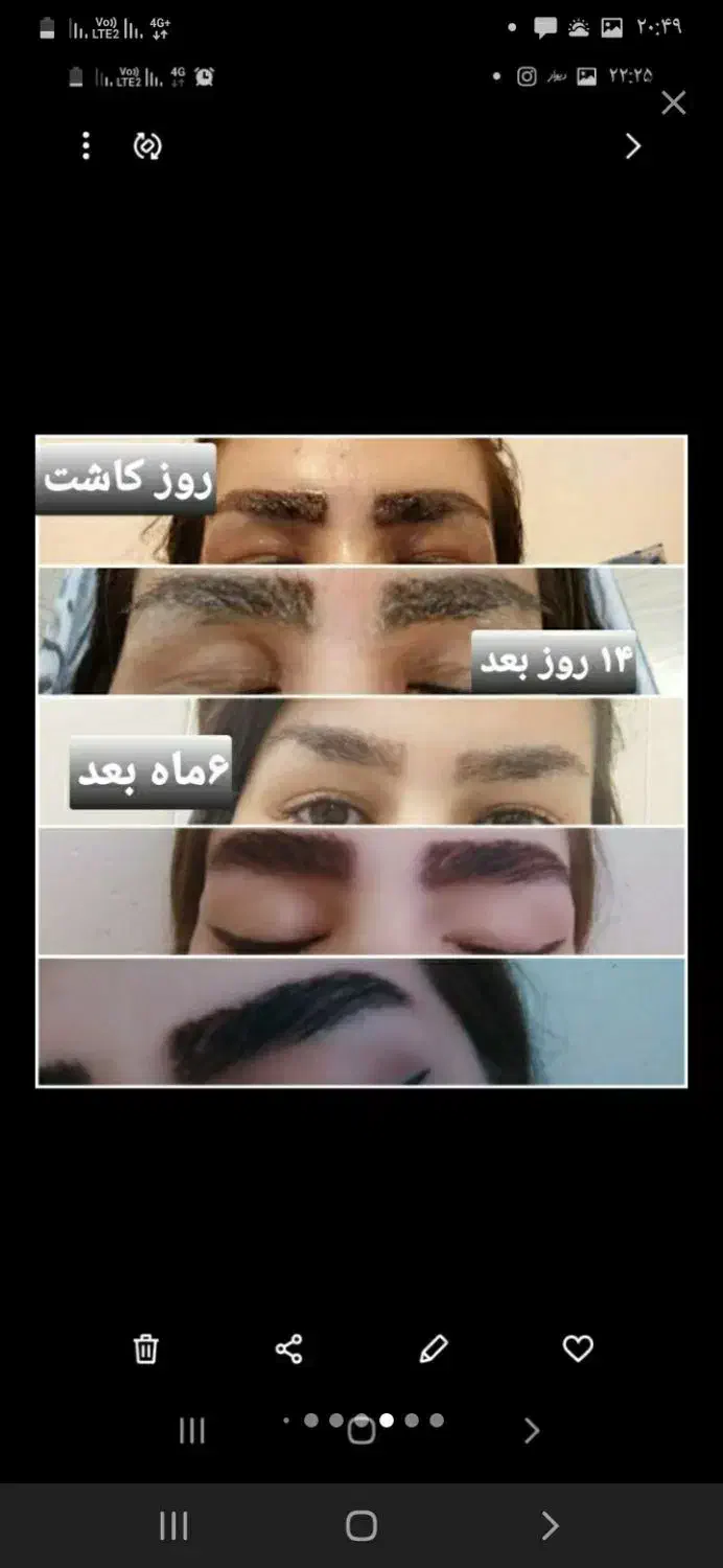 جشنواره کاشت مو و ابرو در تهران و کرج|خدمات آرایشگری و زیبایی|تهران, صاحبقرانیه|دیوار