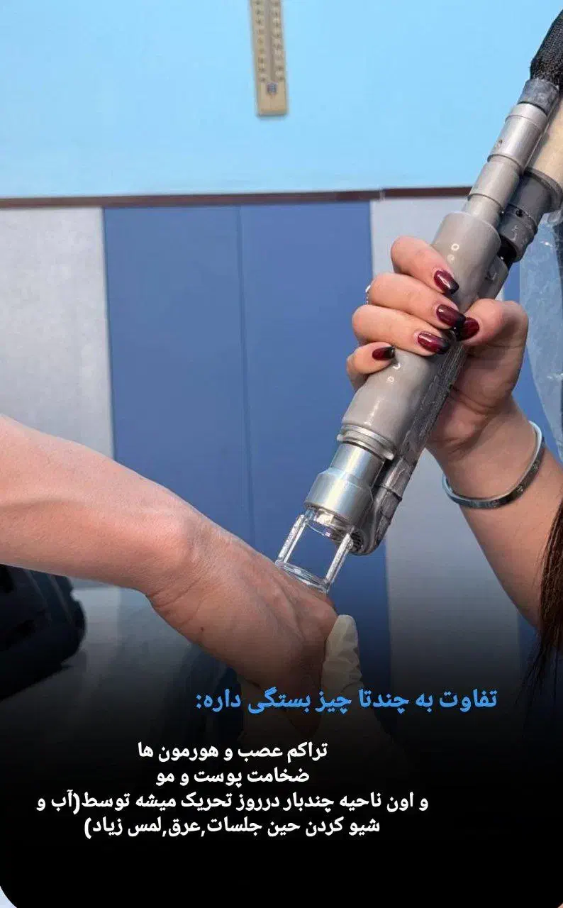 لیزر موی زائد|آرایشی، بهداشتی، درمانی|شیراز, میرزاکوچک خان|دیوار