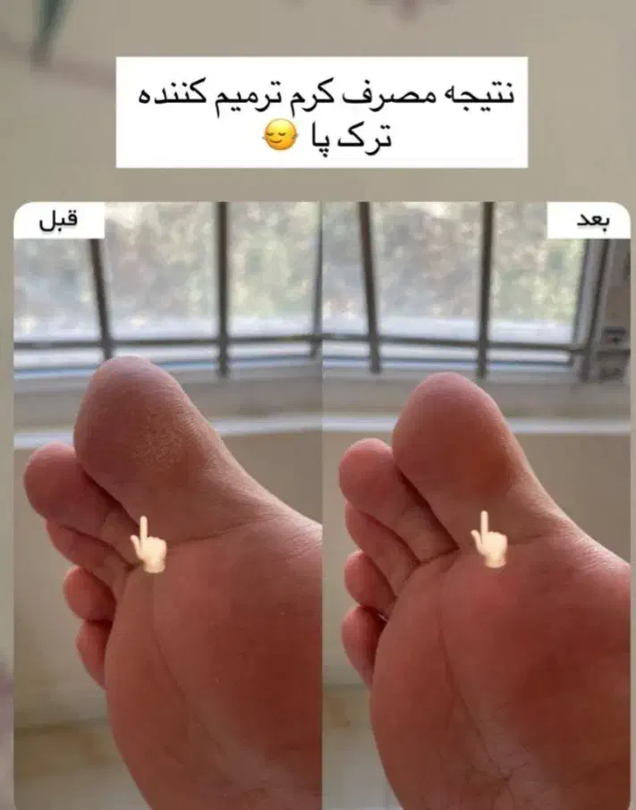 کرم ترکپا وروغن شتر مرغ|آرایشی، بهداشتی، درمانی|تربت جام, جامی|دیوار